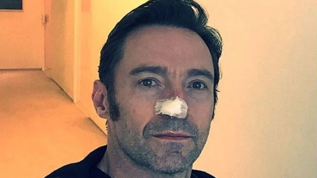 �� �������: ��� �� ������ 